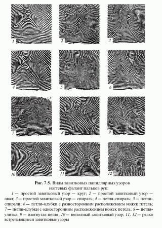 Виды петлевых папиллярных узоров