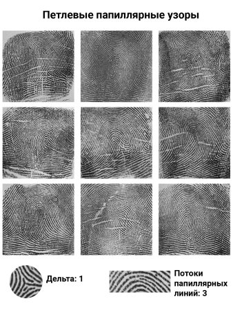 Петлевой Тип папиллярных узоров