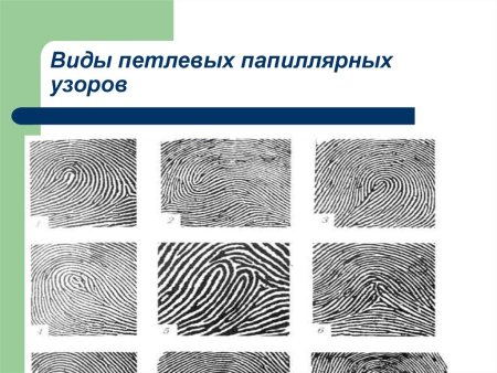 Изобразите схематически основные типы папиллярных узоров
