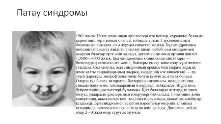 Синдром Эдвардса Патау симптомы