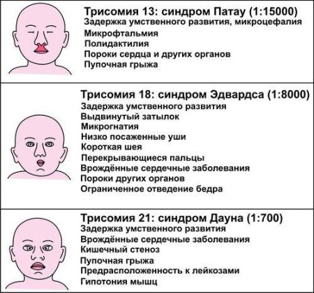 Синдром Патау проявления