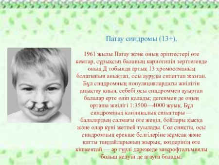 Синдром Патау трисомия по 13 хромосоме кариотип