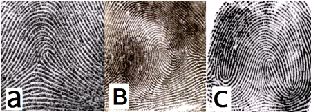 Двойная петля дерматоглифика