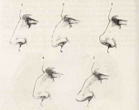 Формы Носов у человека