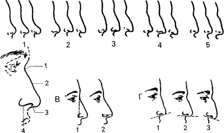 Форма ноздрей криминалистика