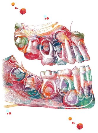 Зуб абстракция