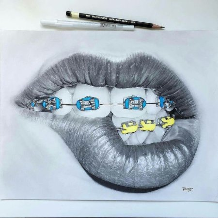 Картина зубы с брекетами