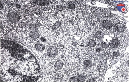 Микрофотографии гистология