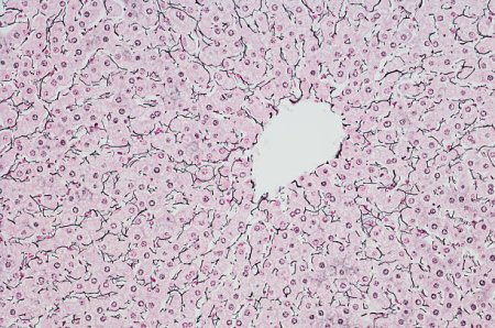 Микрофотография печени