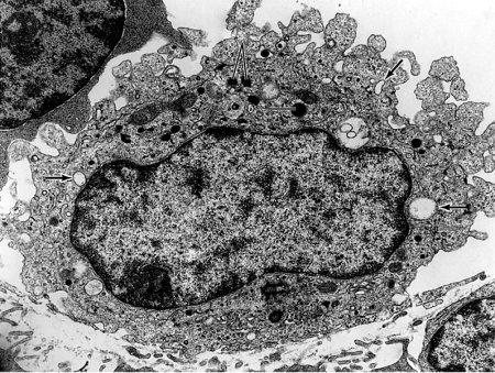 Макрофаг микрофотография гистология