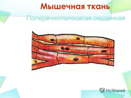 Поперечнополосатая мышечная ткань человека