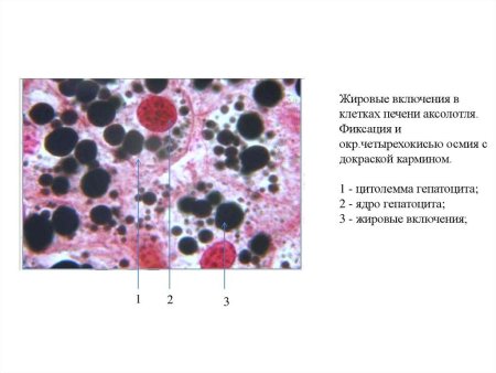 Гепатоциты печени строение