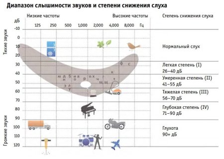 Диапазон слышимости звуков и степени снижения слуха