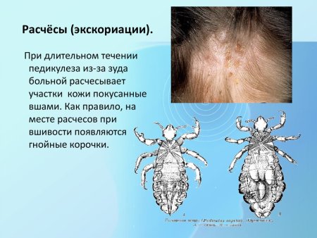 Ctenocephalides canis