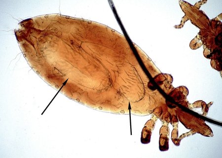 Насекомые эктопаразиты человека