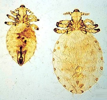 Внешнее строение вши