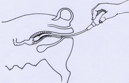 Технологии искусственного осеменения свиноматок