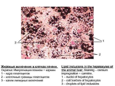 Гепатоциты печени строение