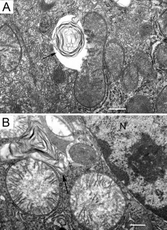 Микропрепараты клеток растений под микроскопом