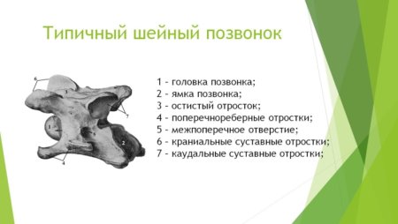 Строение типичного позвонка коровы