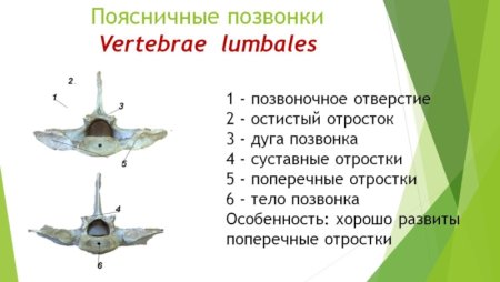 Поясничный позвонок коровы строение