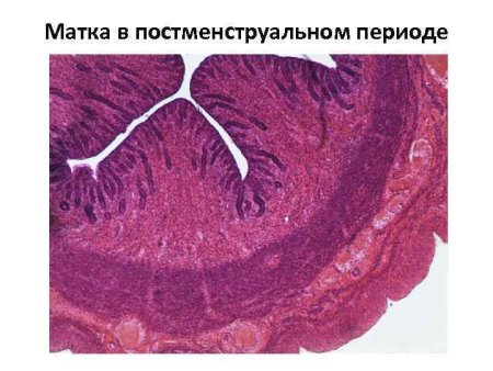 Матка постменструальный период препарат гистология