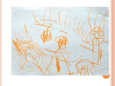 Стадия ритмических каракулей