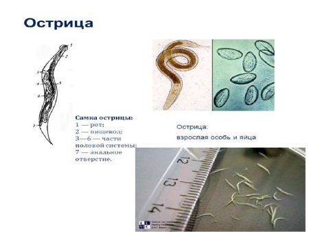 Тотальный препарат самки острицы Enterobius vermicularis