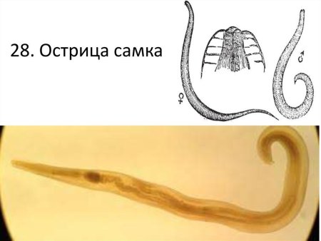 Нервная система острицы