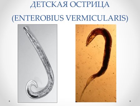 Острица детская Enterobius vermicularis