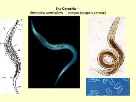Острица (Enterobius vermicularis) рисунок