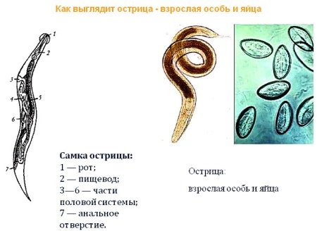 Аскариды, токсокары, острицы.