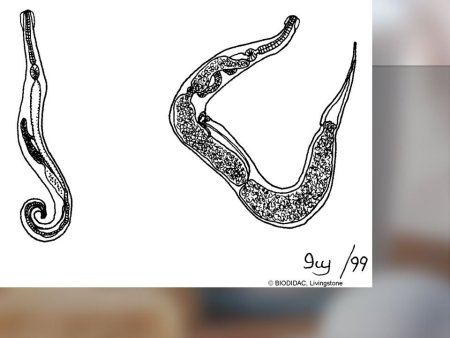 Острица Enterobius vermicularis строение