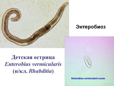 Острица детская Enterobius vermicularis