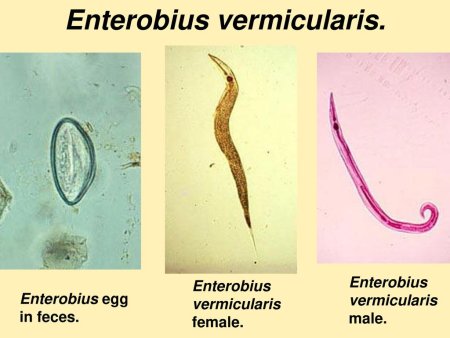 Острица детская Enterobius vermicularis