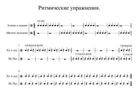 Ритмический рисунок