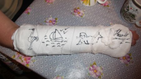 Что нарисовать на гипсе