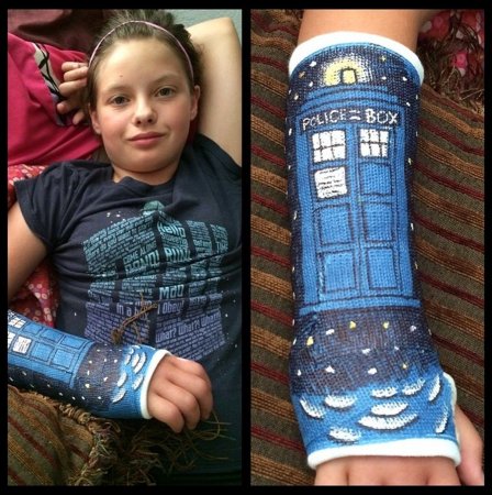 Разрисованный гипс на руке ребенка