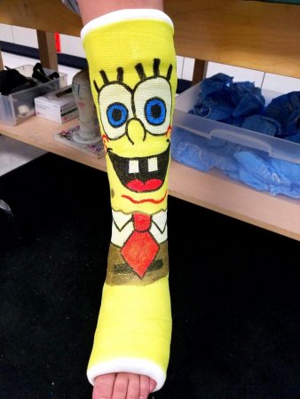 Креативный гипс на ноге