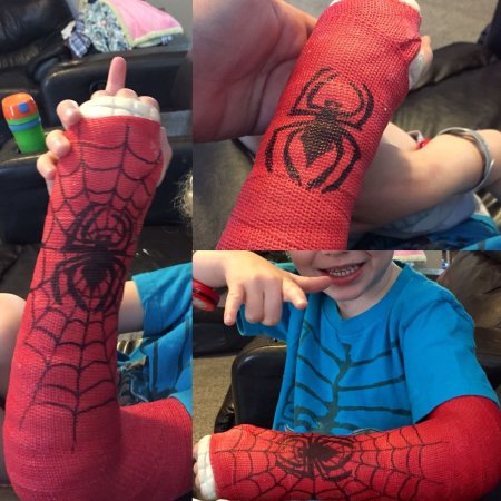 Чехол на гипс на руку детский