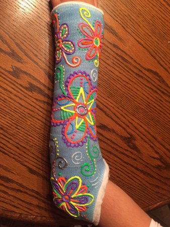 Гипсы для рисования