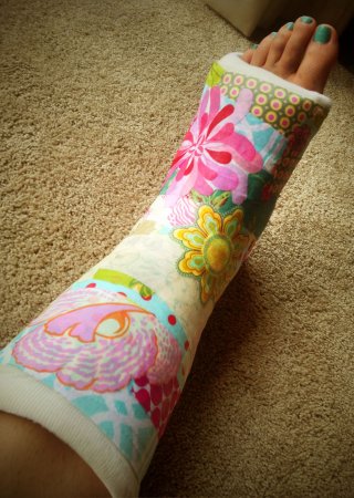 Разрисованный гипс