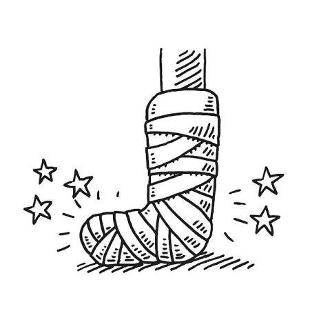 Рисунки на гипсе на ноге