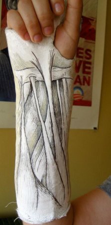 Разрисованный гипс на ноге