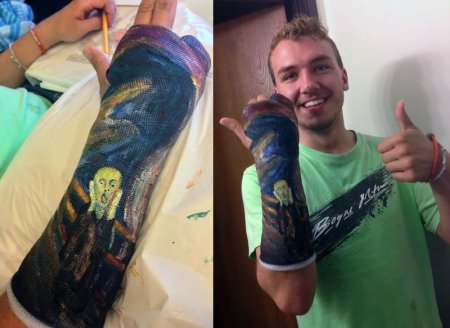 Украшения гипса на руке