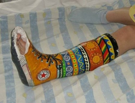 Разрисованный гипс