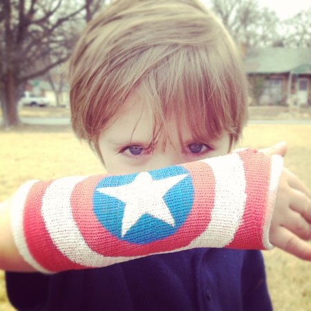 Разрисованный гипс на ноге