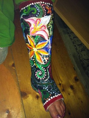 Рисунки на гипсе