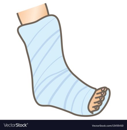 Нога в гипсе на белом фоне