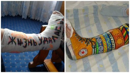 Красивый чехол на гипс